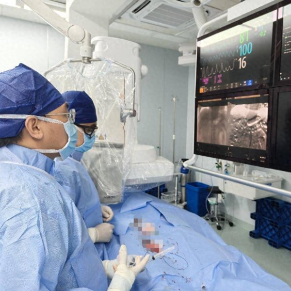 银河证券 碘造影剂过敏，如何做介入治疗？浙江省人民医院专家介绍新方法